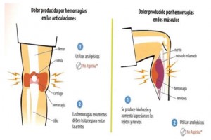 artroza articulației cotului stâng 1 grad